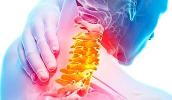 Signs of osteochondrosis of the cervical column