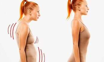 The reasons for the development of cervical osteochondosis