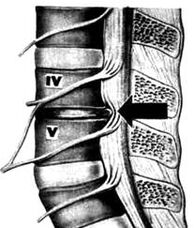 X-ray image of the lumbar department of osteochondrosis