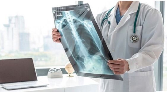 X-ray diagnosis of pain under the left scapula