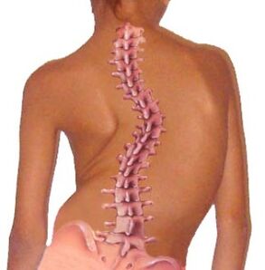 Curvature of the spine leads to osteochondrosis